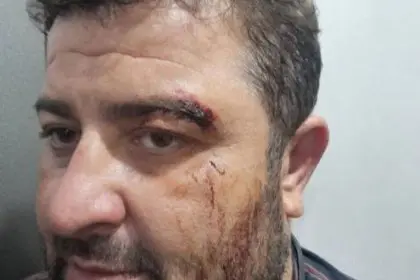 Timber Smugglers Injured Natural Resources Protection Unit Officers in Gilan