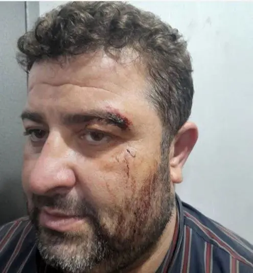Timber Smugglers Injured Natural Resources Protection Unit Officers in Gilan