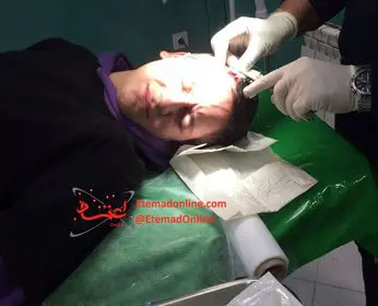 Images of Pellets in Skull of 15-Year-Old Protester