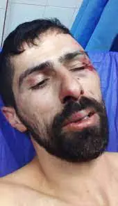 Attack on Iranian National Ski Team Member with a Machete