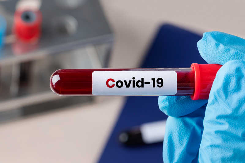 Increase in the prevalence of COVID-19 in red cities in Iran