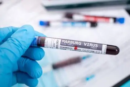 Arab Countries Warn Travelers About Marburg Virus