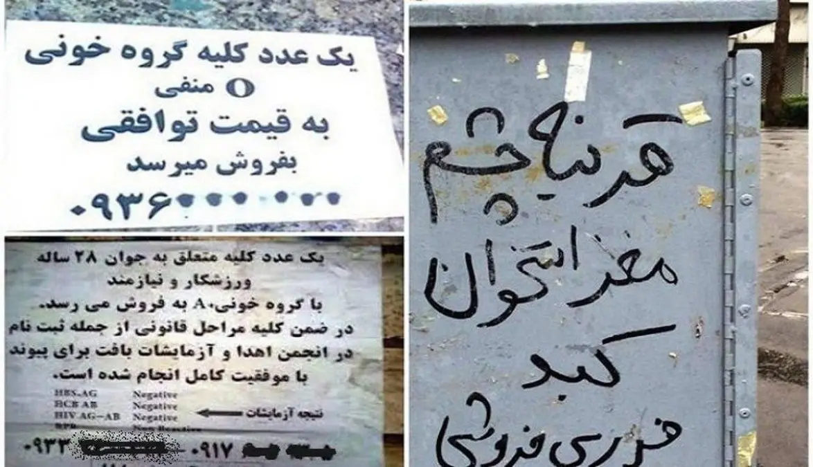 Iraqis buy Iranian kidneys with dollars