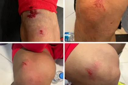 Artificial Turf in Stadium Causes Injury to Iranian National Team Players