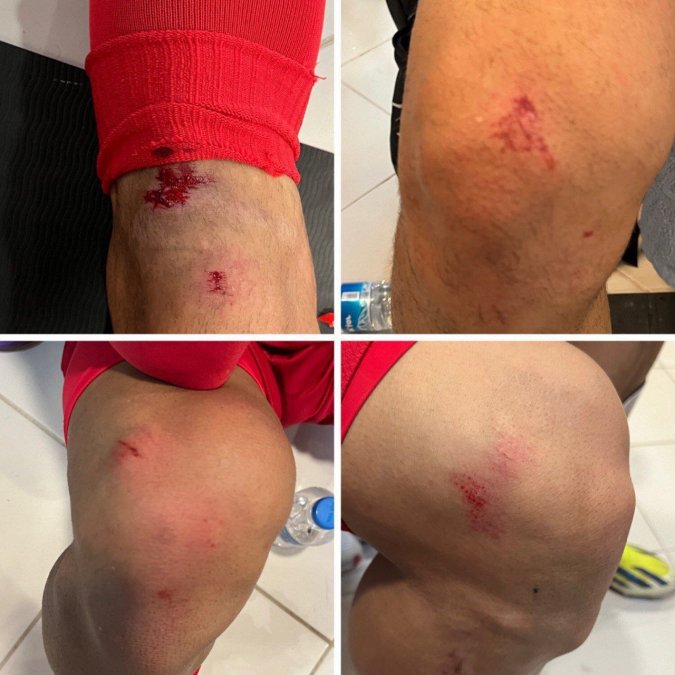 Artificial Stadium Turf Caused Injuries to Iranian National Team Players