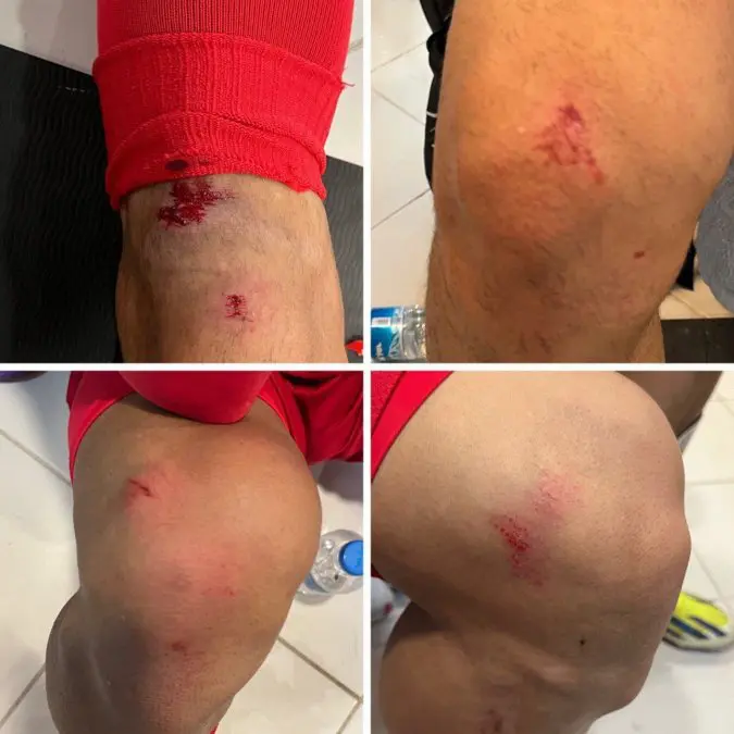 Artificial Turf in Stadium Causes Injury to Iranian National Team Players